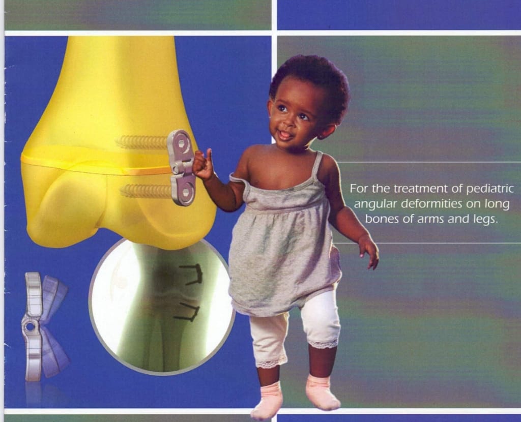 الصياد لجراحة العظام