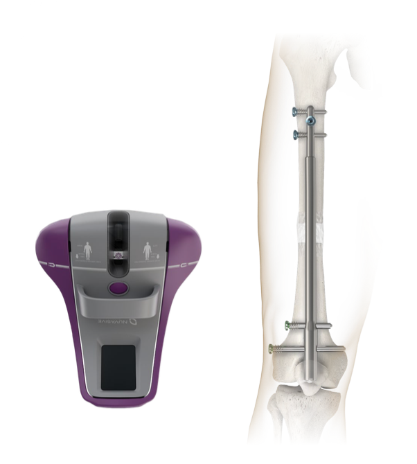 الصياد لجراحة العظام